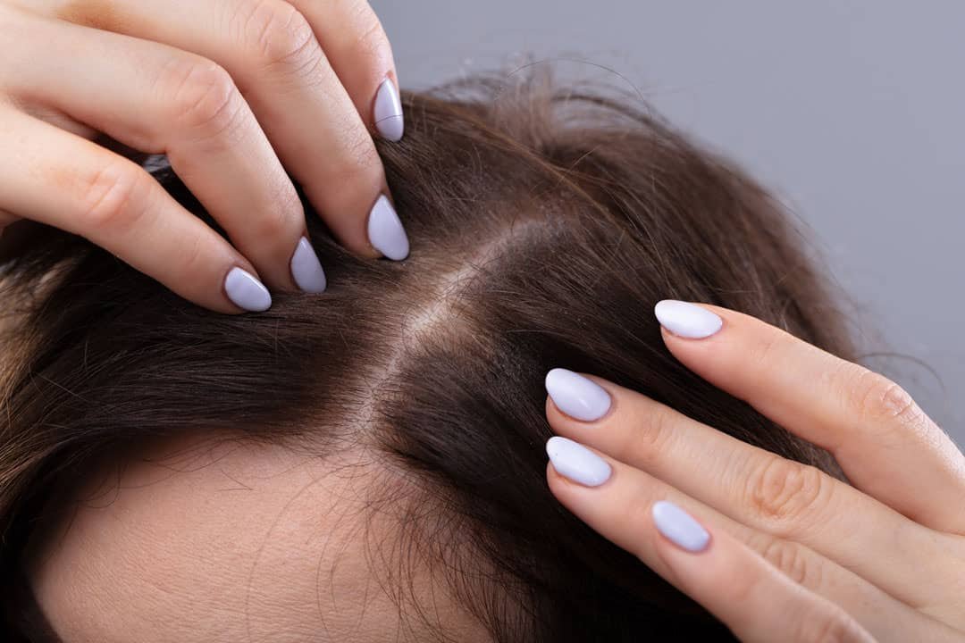 Hair Restoration
